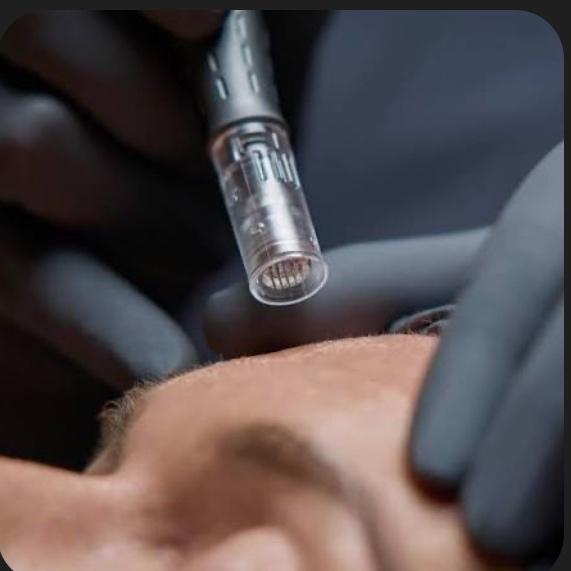 Micro-needling (Package of 3)